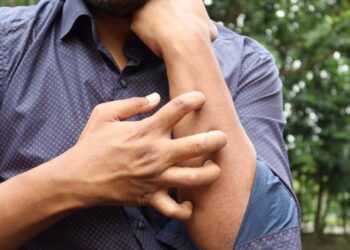 Pacientes de América buscan atención en AlergiaMx: un modelo clínico y académico que cruza fronteras