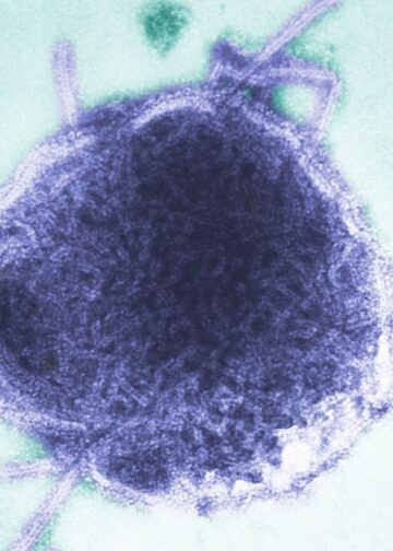 Secretaría de Salud advierte por sarampión: los siete estados que concentran el 85% de los casos en México